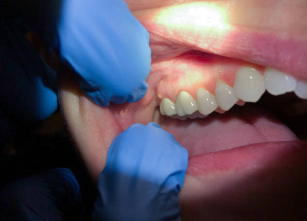 Best Knocked-Out Tooth Emergency  in West Dundee, IL